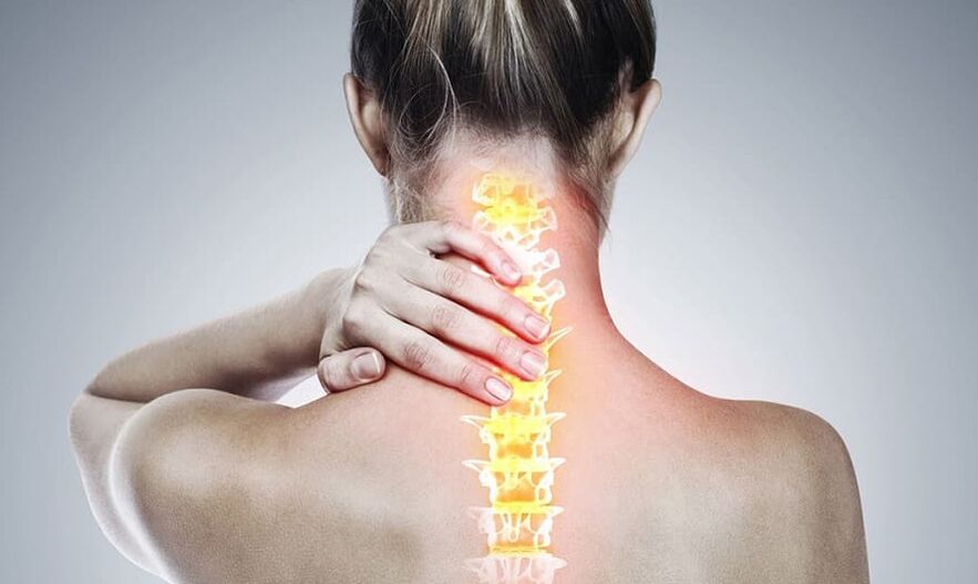 Остеохондроза на шийните прешлени